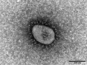 CLIP：コロナウイルスのゲノム変異に未知の仕組みか、大流行解明に光 東北大